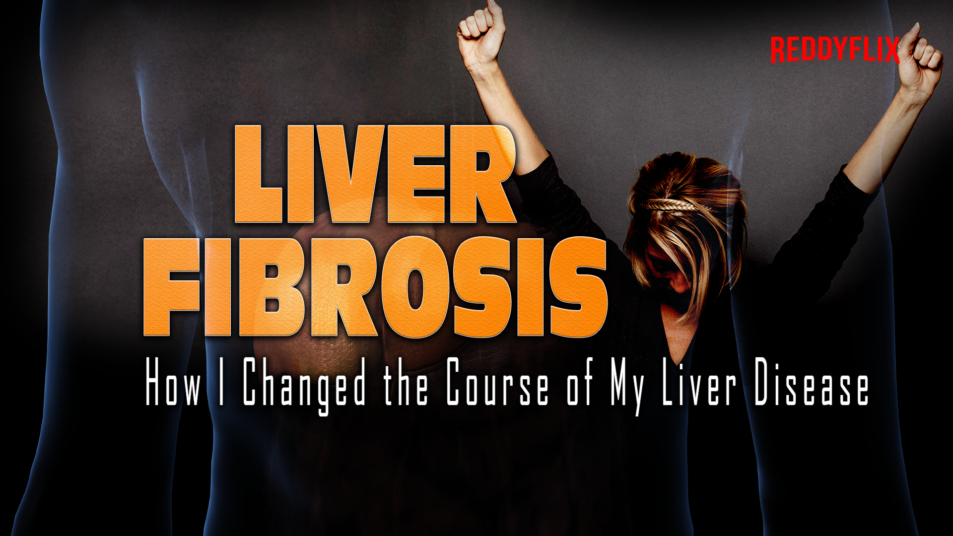 LIVER FIBROSIS: How I Changed the Course of My Liver Disease